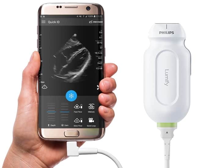 Philips Lumify Ultrasound